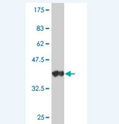 Western Blot: Nicotinic Acetylcholine R alpha 4/CHRNA4 Antibody (4E3) [H00001137-M01]