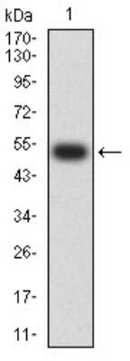 Western Blot: Nicotinic Acetylcholine R alpha 4/CHRNA4 Antibody (7B4H1)BSA Free [NBP2-61674]