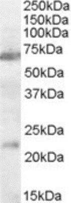 Western Blot: Nicotinic Acetylcholine R alpha 4/CHRNA4 Antibody [NBP1-00143]