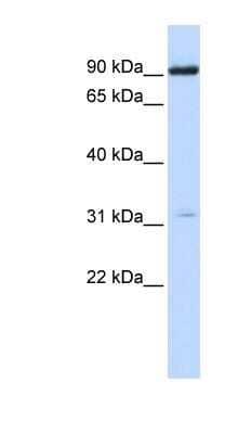 Western Blot: Nicotinic Acetylcholine R alpha 4/CHRNA4 Antibody [NBP1-79947]