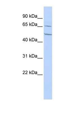 Western Blot: Nicotinic Acetylcholine R alpha 4/CHRNA4 Antibody [NBP1-80057]