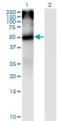 Western Blot: Nicotinic Acetylcholine R alpha 5/CHRNA5 Antibody (7D3) [H00001138-M01]