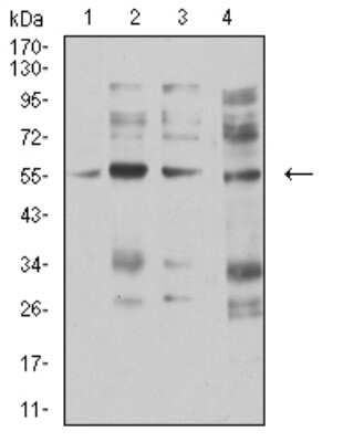 Western Blot: Nicotinic Acetylcholine R alpha 5/CHRNA5 Antibody (8F11G8)BSA Free [NBP2-61678]