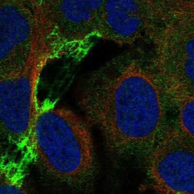 Immunocytochemistry/ Immunofluorescence: Nicotinic Acetylcholine R alpha 5/CHRNA5 Antibody [NBP2-49128]