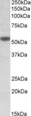 Western Blot: Nicotinic Acetylcholine R alpha 5/CHRNA5 Antibody [NBP1-78791]