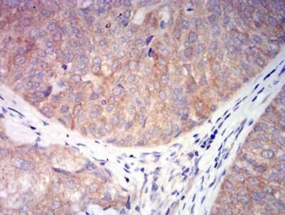 Immunohistochemistry: Nicotinic Acetylcholine R alpha 6/CHRNA6 Antibody (5B6G8) - BSA Free [NBP2-61679]