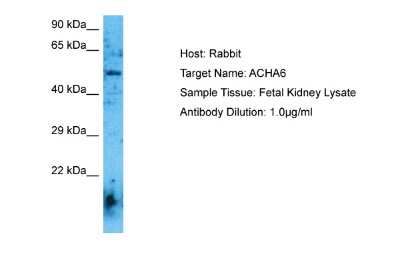 Western Blot: Nicotinic Acetylcholine R alpha 6/CHRNA6 Antibody [NBP2-84181]