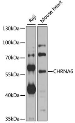 Western Blot: Nicotinic Acetylcholine R alpha 6/CHRNA6 AntibodyBSA Free [NBP2-94679]