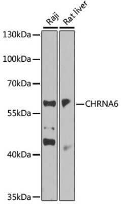 Western Blot: Nicotinic Acetylcholine R alpha 6/CHRNA6 AntibodyBSA Free [NBP2-94824]