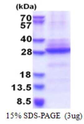 SDS-PAGE: Recombinant Human Nicotinic Acetylcholine R alpha 6/CHRNA6 His Protein [NBP2-51586]