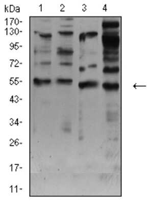 Western Blot: Nicotinic Acetylcholine R alpha 7/CHRNA7 Antibody (7F10F1)BSA Free [NBP2-61738]