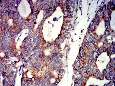 Immunohistochemistry-Paraffin: Nicotinic Acetylcholine R alpha 7/CHRNA7 Antibody (7F10G1) - BSA Free [NBP2-61739]