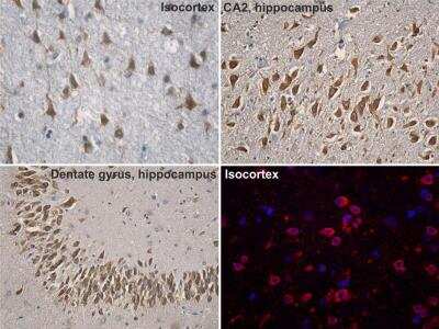 Immunohistochemistry-Paraffin: Nicotinic Acetylcholine R alpha 7/CHRNA7 Antibody [NBP1-52375]