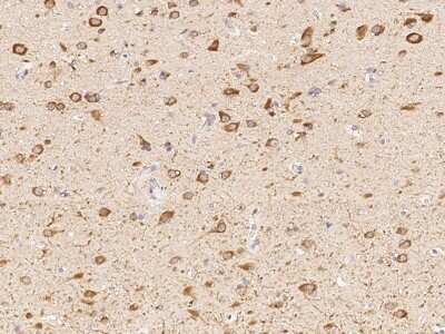 Immunohistochemistry-Paraffin: Nicotinic Acetylcholine R alpha 7/CHRNA7 Antibody [NBP2-99069]