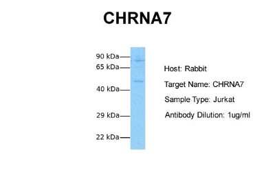 Western Blot: Nicotinic Acetylcholine R alpha 7/CHRNA7 Antibody [NBP1-79948]