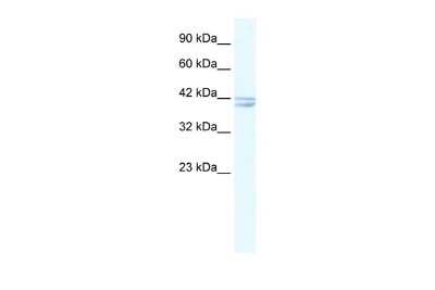 Western Blot: Nicotinic Acetylcholine R alpha 7/CHRNA7 Antibody [NBP1-79948]