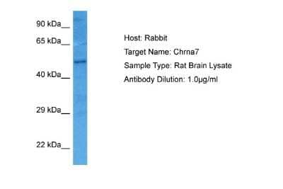 Western Blot: Nicotinic Acetylcholine R alpha 7/CHRNA7 Antibody [NBP1-79948]