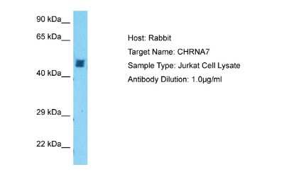 Western Blot: Nicotinic Acetylcholine R alpha 7/CHRNA7 Antibody [NBP1-79948]