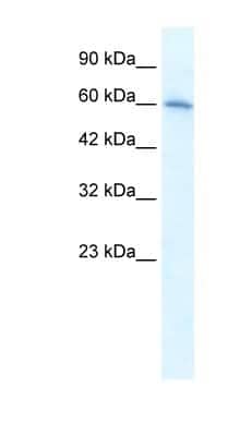 Western Blot: Nicotinic Acetylcholine R alpha 7/CHRNA7 Antibody [NBP1-80092]