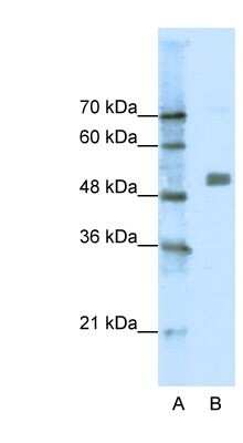 Western Blot: Nicotinic Acetylcholine R alpha 9/CHRNA9 Antibody [NBP1-79949]