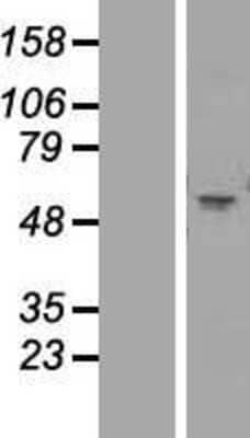 Western Blot: Nicotinic Acetylcholine R alpha 1/CHRNA1 Overexpression Lysate [NBP2-10611]