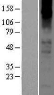 Western Blot: Nicotinic Acetylcholine R alpha 2/CHRNA2 Overexpression Lysate [NBP2-04175]