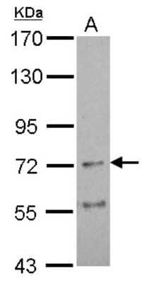 Western Blot: Nicotinic Acetylcholine R alpha 4/CHRNA4 Antibody [NBP2-19539]