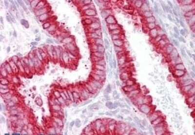 Immunohistochemistry-Paraffin: Nicotinic Acetylcholine Receptor beta 2 Antibody [NBP1-28467]