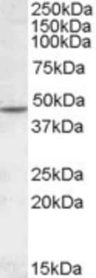 Western Blot: Nicotinic Acetylcholine Receptor beta 2 Antibody [NBP1-28467]