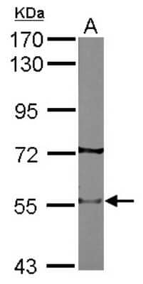 Western Blot: Nicotinic Acetylcholine Receptor beta 2 Antibody [NBP2-15040]