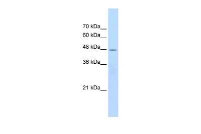 Western Blot: Nicotinic Acetylcholine Receptor beta 2 Antibody [NBP2-82288]