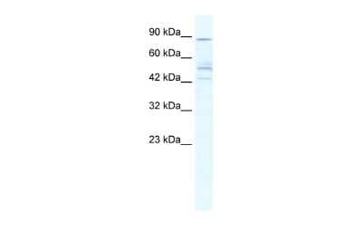 Western Blot: Nicotinic Acetylcholine Receptor beta 2 Antibody [NBP2-82289]