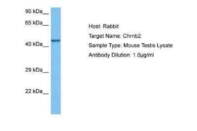 Western Blot: Nicotinic Acetylcholine Receptor beta 2 Antibody [NBP2-82290]