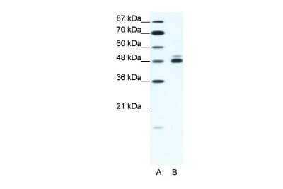 Western Blot: Nicotinic Acetylcholine Receptor beta 2 Antibody [NBP2-82291]