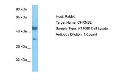 Western Blot: Nicotinic Acetylcholine Receptor beta 2 Antibody [NBP2-82291]