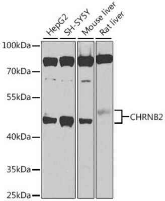 Western Blot: Nicotinic Acetylcholine Receptor beta 2 AntibodyBSA Free [NBP2-93318]