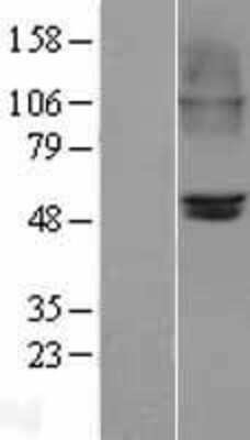 Western Blot: Nicotinic Acetylcholine Receptor beta 2 Overexpression Lysate [NBL1-09187]