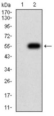 Western Blot: Nicotinic Acetylcholine Receptor beta 4 Antibody (1H11F2)BSA Free [NBP2-61743]