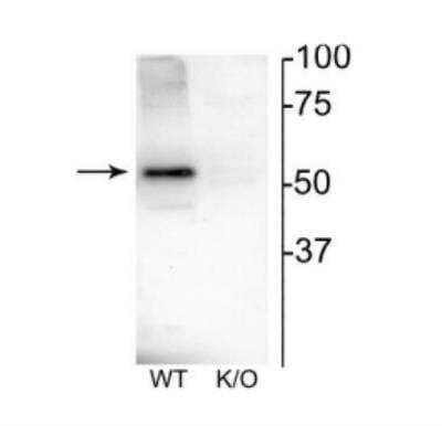 Western Blot: Nicotinic Acetylcholine Receptor beta 4 Antibody [NBP2-60788]