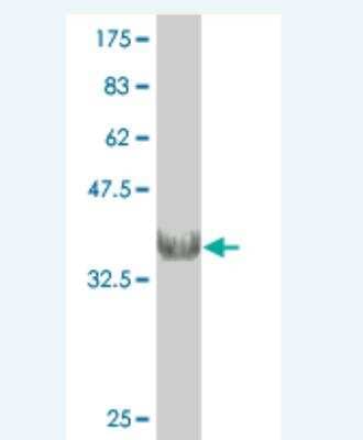 Western Blot: Nicotinic Acetylcholine Receptor beta Antibody (4G4) [H00001140-M01]