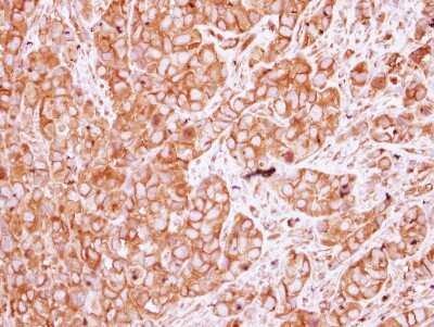 Immunohistochemistry-Paraffin: Nicotinic Acetylcholine Receptor beta Antibody [NBP2-19540]