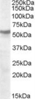 Western Blot: Nicotinic Acetylcholine Receptor beta Antibody [NBP1-20900]