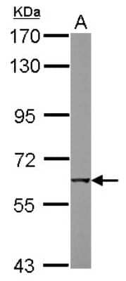 Western Blot: Nicotinic Acetylcholine Receptor beta Antibody [NBP2-19540]