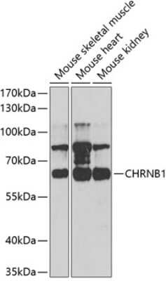 Western Blot: Nicotinic Acetylcholine Receptor beta AntibodyBSA Free [NBP2-93445]