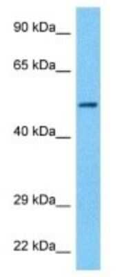 Western Blot: Nicotinic Acetylcholine Receptor beta Antibody [NBP3-10350]