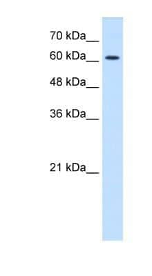 Western Blot: Nicotinic Acetylcholine Receptor epsilon Antibody [NBP1-79951]