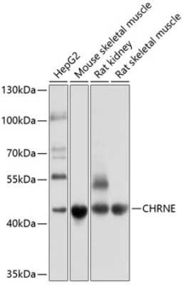 Western Blot: Nicotinic Acetylcholine Receptor epsilon AntibodyBSA Free [NBP2-94553]