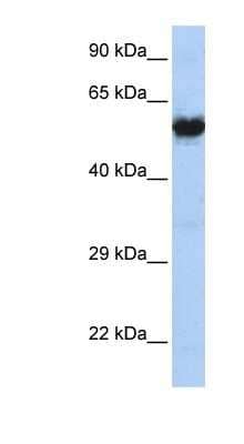 Western Blot: Nicotinic Acetylcholine Receptor gamma Antibody [NBP1-79952]