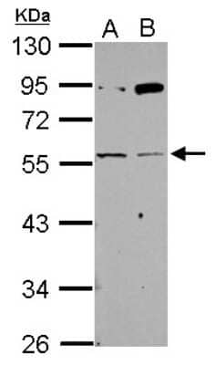 Western Blot: Nicotinic Acetylcholine Receptor gamma Antibody [NBP2-19541]