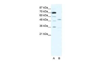 Western Blot: Nicotinic Acetylcholine Receptor gamma Antibody [NBP2-86731]